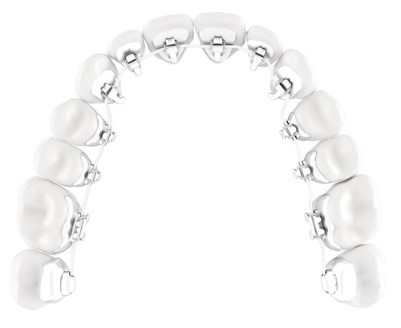 orthodontie ado 3