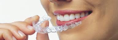 orthodontie adulte 3